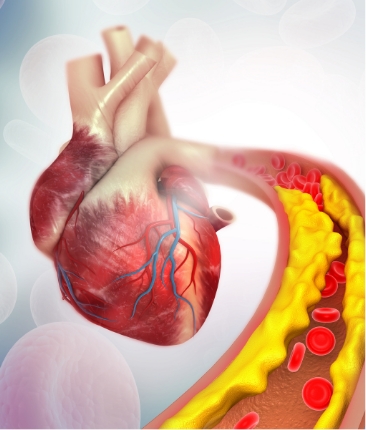 Cardiac CT Angiogram