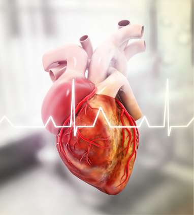 Cardiac resynchronization therapy