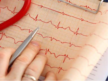 Common Arterial Interventions