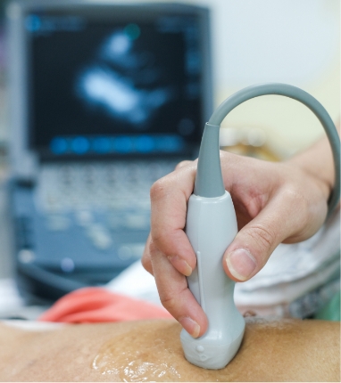 echocardiogram