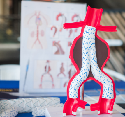 Endovascular Aneurysm Repair