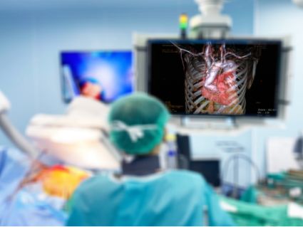 Heart Valve Surgeries
